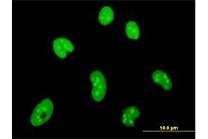 Immunofluorescence of monoclonal antibody to HMGB1 on HeLa cell. (HMGB1 antibody  (AA 1-215))