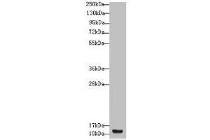 Western blot All lanes: S100A14 antibody at 4. (S1A14 (AA 1-104) antibody)