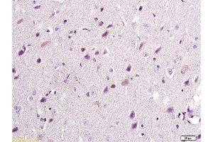 Formalin-fixed and paraffin embedded: rat brain tissue labeled with Anti-NR2B/NMDAR2B Polyclonal Antibody, Unconjugated  at 1:300, followed by conjugation to the secondary antibody and DAB staining (GRIN2B antibody  (AA 451-550))