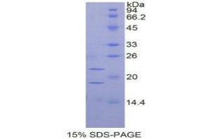 SDS-PAGE (SDS) image for Placenta Growth Factor (PGF) (AA 24-158) protein (His tag) (ABIN2126310)