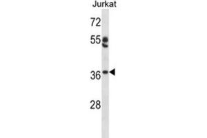 Western Blotting (WB) image for anti-Ovo-Like 1 (OVOL1) antibody (ABIN2998129) (OVOL1 antibody)