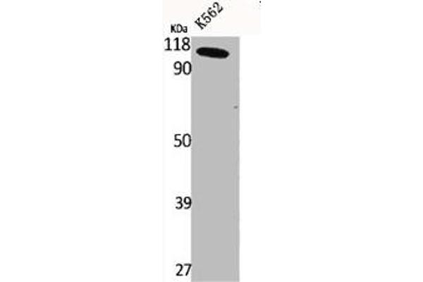 CLCN6 antibody  (Internal Region)