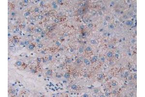 Figure. (TPSAB1 antibody  (AA 161-262))