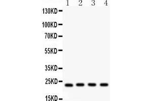 Western Blotting (WB) image for anti-BCL2-Antagonist/killer 1 (BAK1) (AA 22-211) antibody (ABIN3042342)