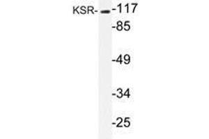 Western blot analysis of KSR antibody in extracts from NIH/3T3 cells. (KSR1 antibody)