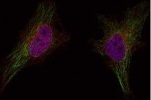 Image no. 1 for anti-Breast Cancer 1 (BRCA1) (Ser1524) antibody (ABIN401621) (BRCA1 antibody  (Ser1524))