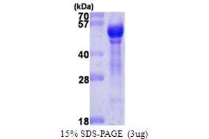 SDS-PAGE (SDS) image for Angiopoietin 1 (ANGPT1) (AA 20-498) protein (ABIN667576)
