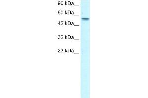 WB Suggested Anti-RUNX1T1 Antibody Titration:  1. (RUNX1T1 antibody  (Middle Region))
