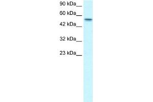 WB Suggested Anti-RUNX1T1 Antibody Titration:  1.