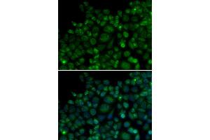 Immunofluorescence analysis of MCF7 cell using TLR7 antibody. (TLR7 antibody)