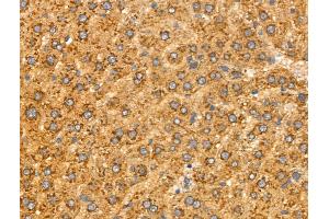 ABIN6258514 and ABIN6274732 at 1/100 staining Rat liver tissue by IHC-P. (MRPL16 antibody  (Internal Region))