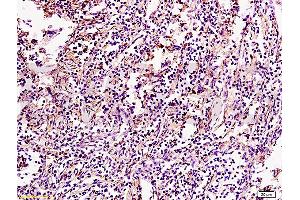 Formalin-fixed and paraffin embedded chicken intestine tissue with labeled Anti-APOA1 Polyclonal Antibody, Unconjugated (ABIN728968) at 1:200, followed by conjugation to the secondary antibody and DAB staining (APOA1 antibody  (AA 51-150))