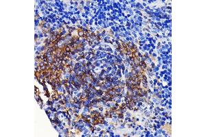 Immunohistochemistry of paraffin-embedded rat spleen using SHP1 Rabbit mAb (ABIN7269716) at dilution of 1:100 (40x lens). (SHP1 antibody)