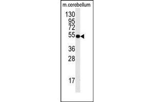 Image no. 1 for anti-Cell Division Cycle 25 Homolog A (S. Pombe) (CDC25A) (Ser78) antibody (ABIN358772) (CDC25A antibody  (Ser78))