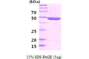 Figure annotation denotes ug of protein loaded and % gel used. (ENO2/NSE Protein (AA 1-434))