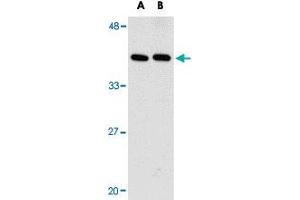 Western blot analysis of PTER in human kidney tissue lysate with PTER polyclonal antibody  at (A) 1 and (B) 2 ug/mL .
