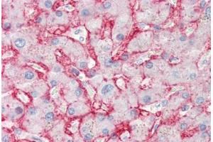Human Liver (formalin-fixed, paraffin-embedded) stained with SLC2A2 antibody ABIN337148 at 10 ug/ml followed by biotinylated anti-mouse IgG secondary antibody ABIN481714, alkaline phosphatase-streptavidin and chromogen. (SLC2A2 antibody)
