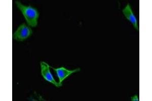 Immunofluorescent analysis of Hela cells using ABIN7163391 at dilution of 1:100 and Alexa Fluor 488-congugated AffiniPure Goat Anti-Rabbit IgG(H+L) (PAG1 antibody  (AA 97-432))