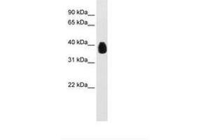 Image no. 1 for anti-Ets Variant 7 (ETV7) (C-Term) antibody (ABIN6736601) (ETV7 antibody  (C-Term))