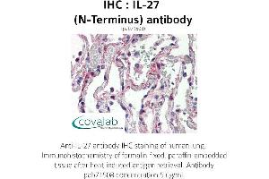 Image no. 1 for anti-Interleukin 27 (IL27) antibody (ABIN1735882) (IL-27 antibody)