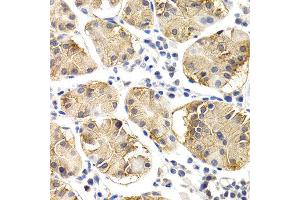 Immunohistochemistry of paraffin-embedded human normal stomach using CHIT1 antibody at dilution of 1:200 (400x lens). (Chitotriosidase 1 antibody)