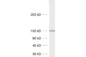 dilution: 1 : 1000, sample: synaptic membrane fraction of rat brain (LP1) (GRIA4 antibody  (AA 850-902))