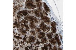Immunohistochemical staining of human stomach with CDCA7 polyclonal antibody  shows strong cytoplasmic positivity in granular pattern in glandular cells at 1:200-1:500 dilution.