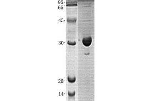 Validation with Western Blot (CLIC4 Protein (His tag))