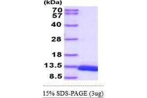 D-Dopachrome Tautomerase (DDT) (AA 1-118) protein (His tag)