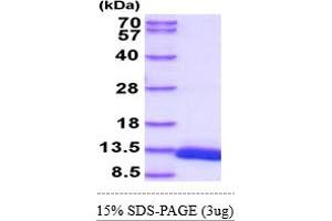 SDS-PAGE (SDS) image for D-Dopachrome Tautomerase (DDT) (AA 1-118) protein (His tag) (ABIN5855100) (DDT Protein (AA 1-118) (His tag))