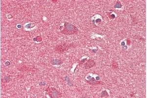 ABIN625820 (5µg/ml) staining of paraffin embedded Human Cortex. (CROT antibody  (C-Term))