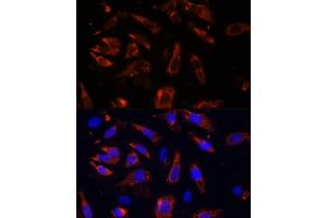 Immunofluorescence analysis of U-2OS cells using MCTS1 antibody (ABIN6132341, ABIN6143657, ABIN6143658 and ABIN6224877) at dilution of 1:100 (40x lens). (MCTS1 antibody  (AA 1-181))