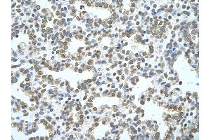 Rabbit Anti-ATG4B Antibody       Paraffin Embedded Tissue:  Human alveolar cell   Cellular Data:  Epithelial cells of renal tubule  Antibody Concentration:   4. (ATG4B antibody  (C-Term))
