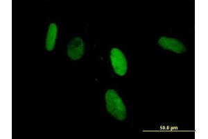 Immunofluorescence of purified MaxPab antibody to ZNF266 on HeLa cell. (ZNF266 antibody  (AA 1-263))