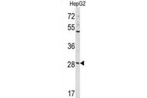 Western Blotting (WB) image for anti-Coiled-Coil Domain Containing 85B (CCDC85B) antibody (ABIN3004037)