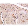 anti-Phosphoinositide 3 Kinase, p85 alpha/gamma (PI3K p85a/g) (pTyr199), (pTyr467) antibody