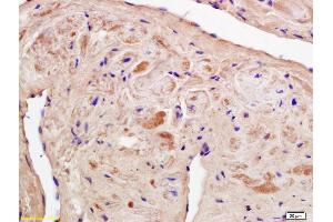 Formalin-fixed and paraffin embedded rat heart labeled with Anti-phospho-PI3K p85(Tyr467) /p55(Tyr199) Polyclonal Antibody, Unconjugated (ABIN744743) at 1:200 followed by conjugation to the secondary antibody and DAB staining. (PI3K p85 alpha/gamma antibody  (pTyr199, pTyr467))