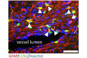 Immunohistochemistry (IHC) image for anti-Lipocalin 2 (LCN2) (AA 21-200) antibody (ABIN7433591)