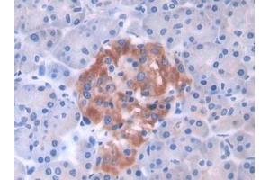 Immunohistochemistry (IHC) image for anti-Glycolipid Transfer Protein (GLTP) (AA 2-209) antibody (ABIN7443623)