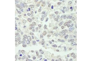 Immunohistochemistry (IHC) image for anti-Karyopherin alpha 3 (Importin alpha 4) (KPNA3) (AA 1-50) antibody (ABIN7448982) (KPNA3 antibody  (AA 1-50))