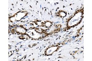 IHC analysis of NOLA1/GAR1 using anti-NOLA1/GAR1 antibody (ABIN7602076). (GAR1 antibody  (AA 58-165))