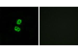 Peptide - +Immunofluorescence analysis of MCF-7 cells, using FGF22 antibody. (FGF22 antibody)