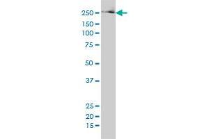 FASN monoclonal antibody (M01), clone 3F2-1F3 Western Blot analysis of FASN expression in 293 . (Fatty Acid Synthase antibody  (AA 1-439))