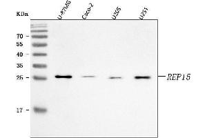 Western blot analysis of REP15 using anti-REP15 antibody (ABIN7601178).