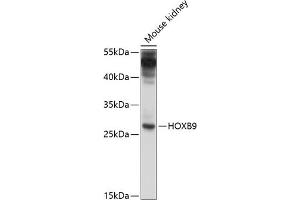 Western blot analysis of extracts of mouse kidney, using HOXB9 antibody  at 1:1000 dilution.
