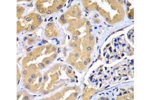 Immunohistochemistry of paraffin-embedded Human kidney using WIPI2 Polyclonal Antibody at dilution of 1:100 (40x lens). (WIPI2 antibody)