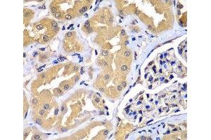 Immunohistochemistry of paraffin-embedded Human kidney using WIPI2 Polyclonal Antibody at dilution of 1:100 (40x lens).