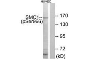 Western blot analysis of extracts from HuvEc cells treated with etoposide 24uM 24h, using SMC1 (Phospho-Ser966) Antibody. (SMC1A antibody  (pSer966))