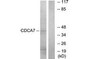 Western blot analysis of extracts from K562 cells, using CDCA7 Antibody.
