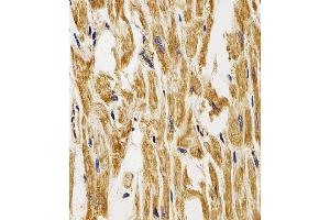 Immunohistochemical analysis of paraffin-embedded H. (FABP3 antibody  (AA 1-133))